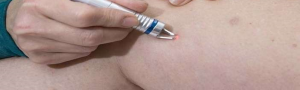 laser vasculaire tunisie