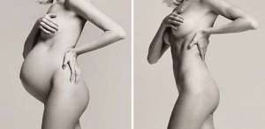 abdominoplastie tunisie