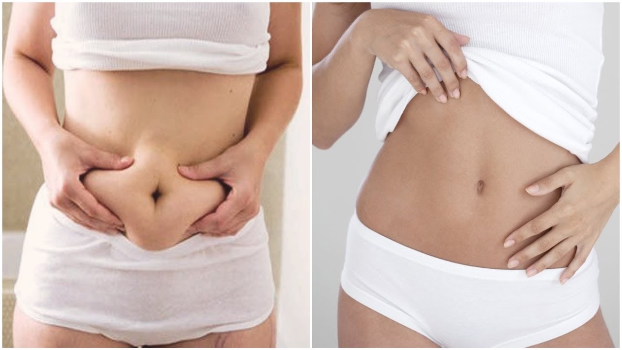 chirurgie ventre plat turquie