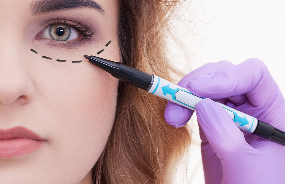 blépharoplastie Turquie
