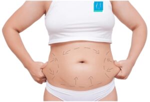 Mini abdominoplastie Turquie