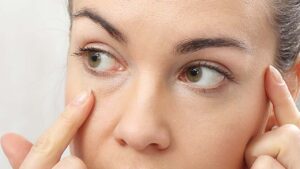 Chirurgie paupières inférieure Turquie